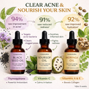 Natural acne care oil bottles from the Lumaura skin trio